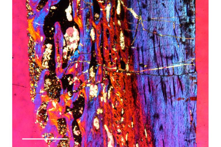 azendohsaurus_histo_Cubo_paleophysiology_pdm.jpg